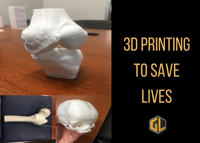 3D Printing to Save Lives News Article